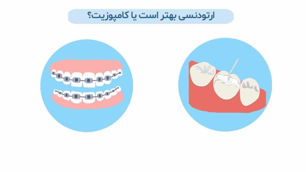 ارتودنسی بهتر است یا کامپوزیت؟