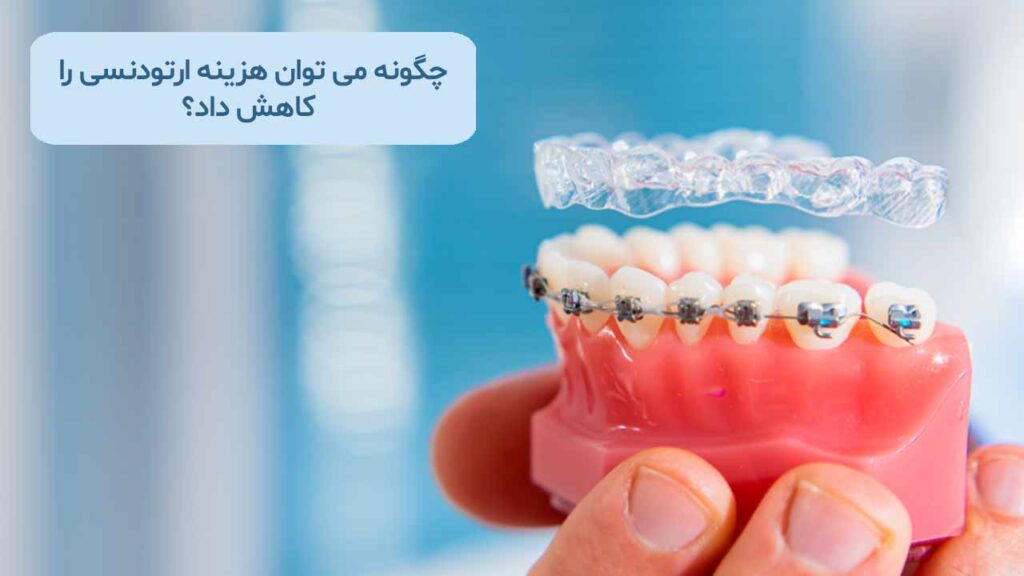 چگونه می توان هزینه ارتودنسی را کاهش داد؟