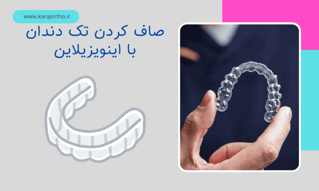 صاف کردن تک دندان با اینویزیلاین