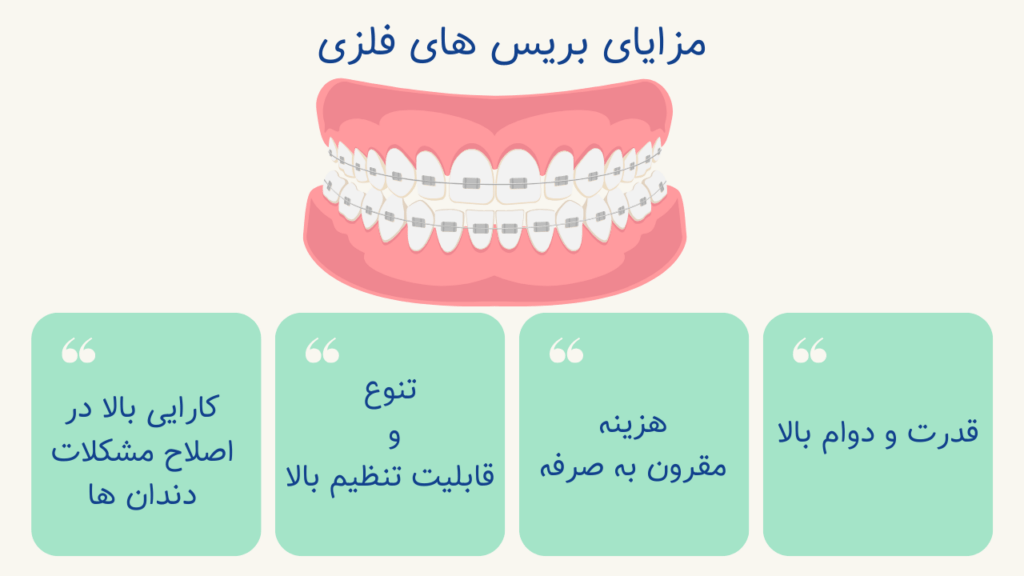 مزایای بریس های فلزی